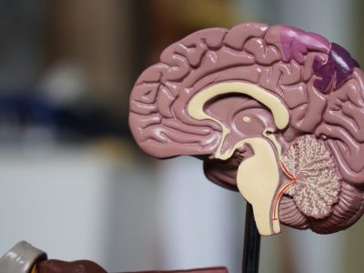image of a brain before brain injury TBI or CTE